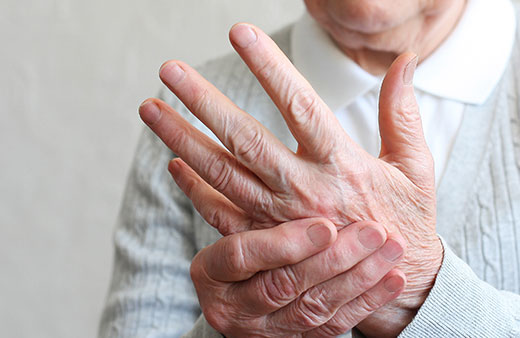 Arthritis (Rheumatoid Factor) Home Test Kit UK